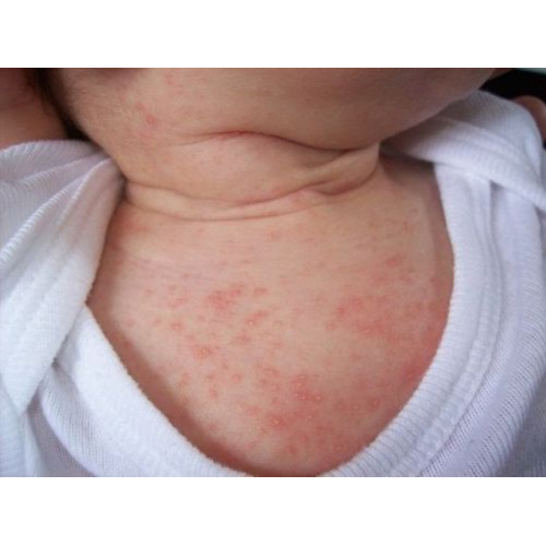 Lợi Ích Sức Khỏe Bất Ngờ Của Khổ Qua